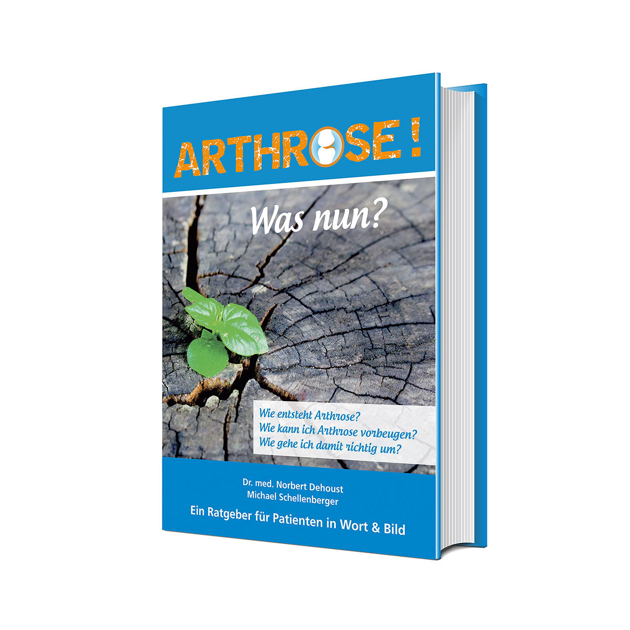 Arthrose! Was nun?